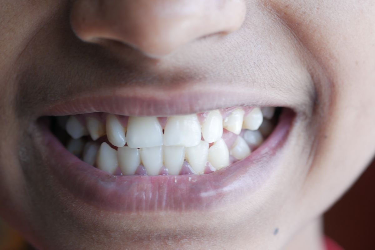 Close-up of a bright natural smile